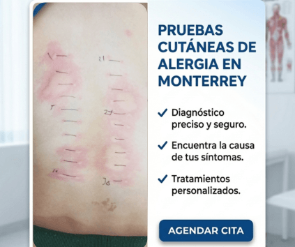 Resultado positivo real de prueba cutánea de alergia con ronchas visibles en paciente, diagnóstico preciso con alergólogo en Monterrey NL